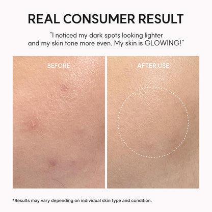 Arencia NAD+ Serum Booster Shot 30ml