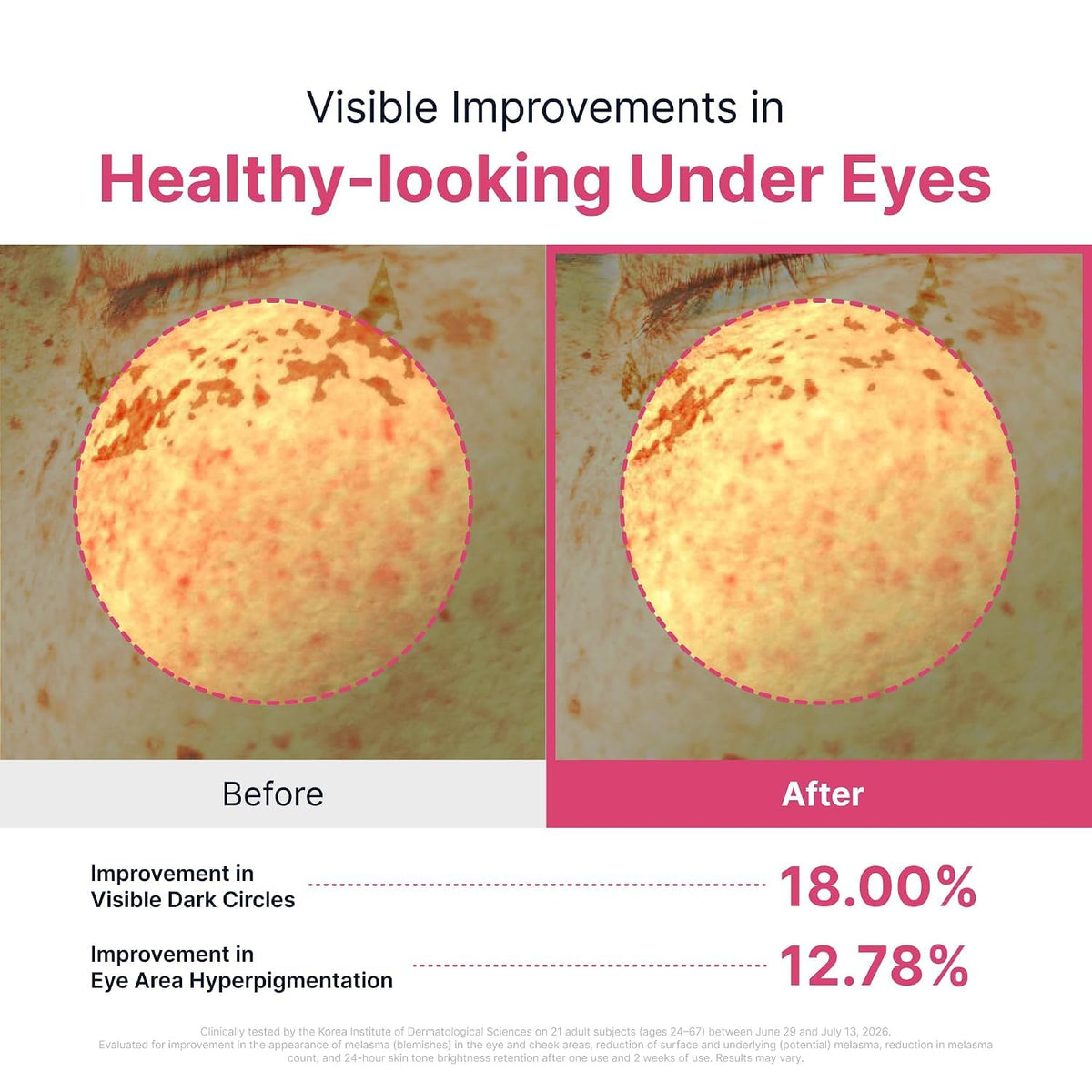 SUNGBOON EDITOR  Hydrogel Eye Patch, 3.17 oz. (90Patches)