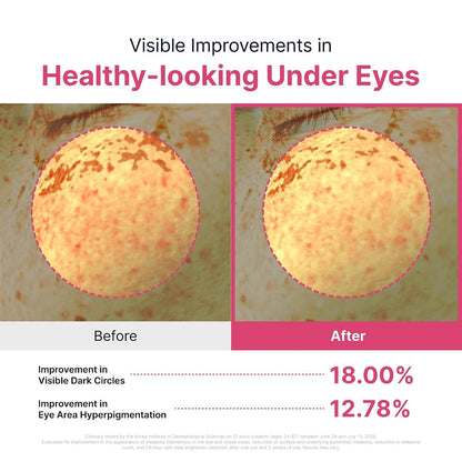 SUNGBOON EDITOR  Hydrogel Eye Patch, 3.17 oz. (90Patches)