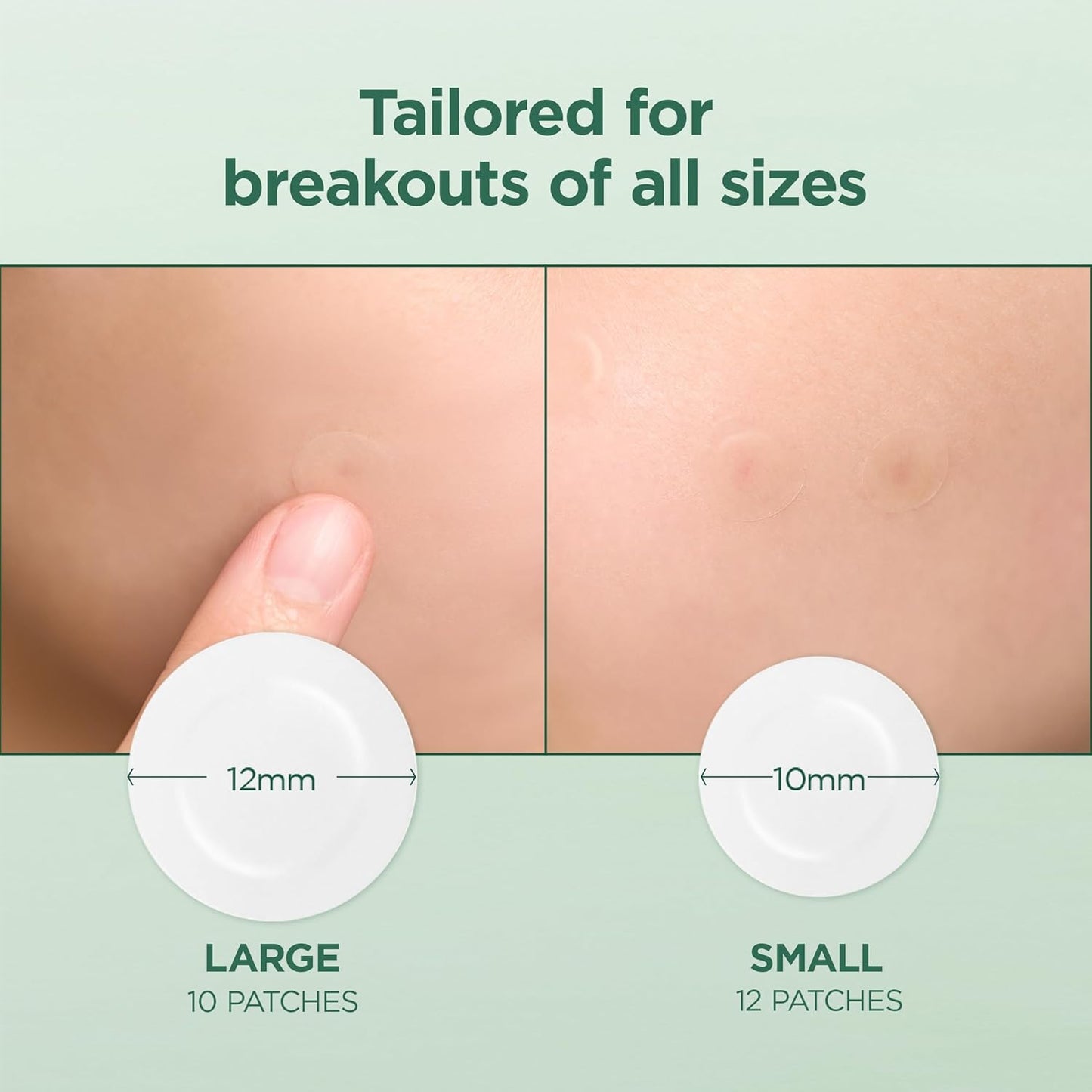 SKIN1004 Tea-Trica Spot Cover Patch (22 Patches) 🌿✨