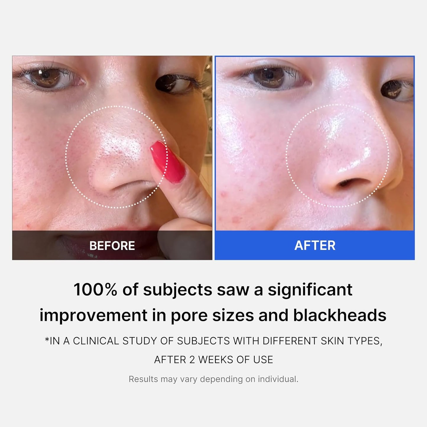 Medicube Zero Pore Pads 2.0 UAE