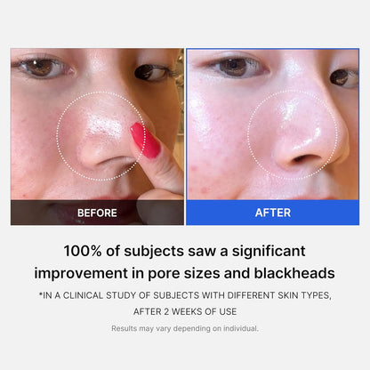 Medicube Zero Pore Pads 2.0 UAE
