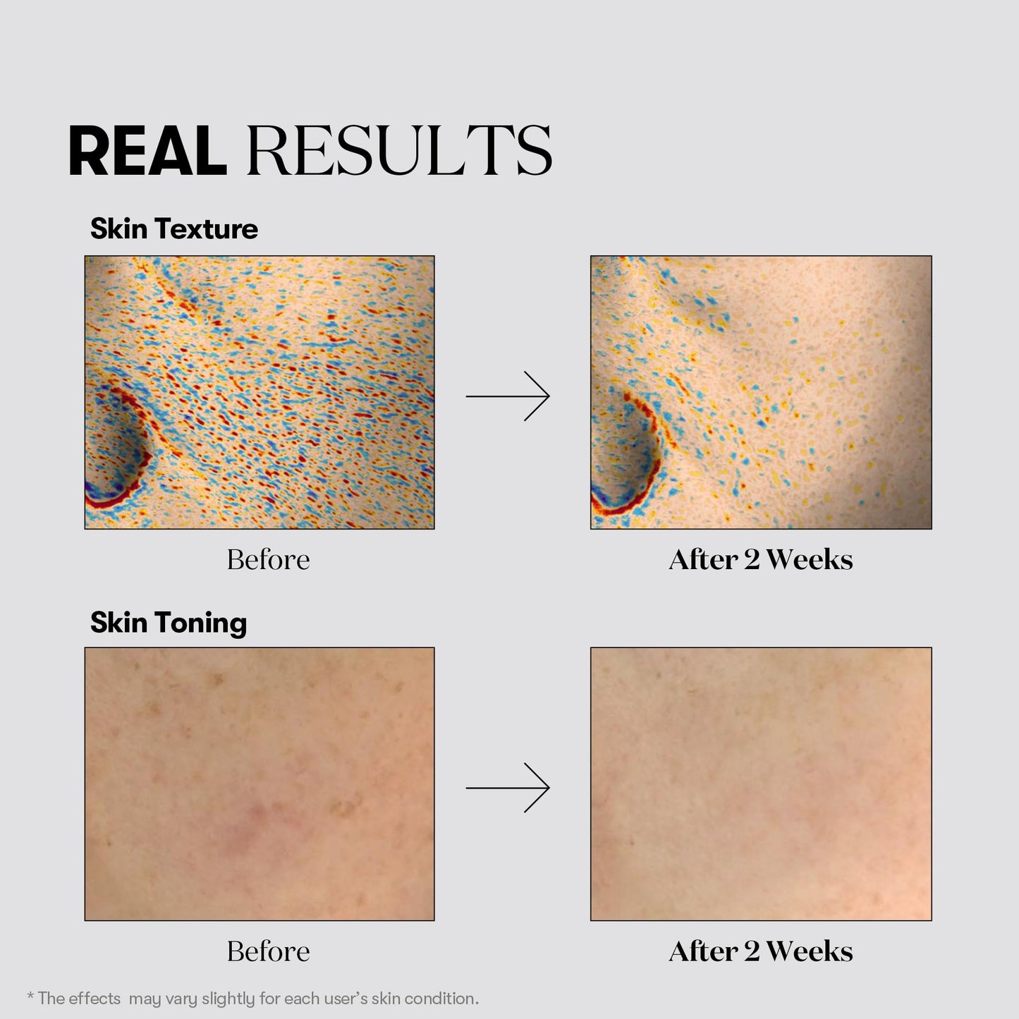 VT COSMETICS Reedle Shot Vita-Light Radiant Daily Mask (30 Sheets) ✨🌿