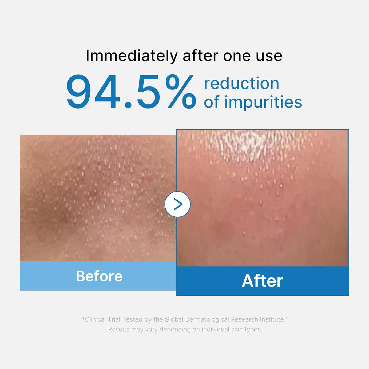 Medicube Zero Pore Blackhead Cleansing Oil – 205ml