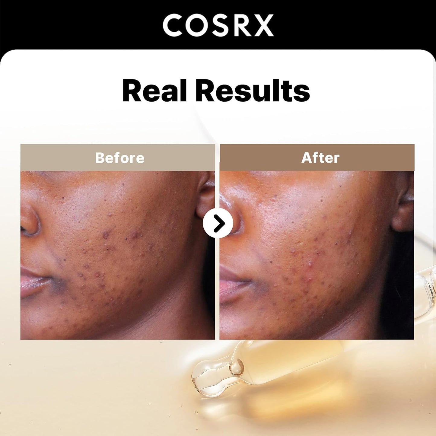 [COSRX] Glow & Tone Duo – Peptide Booster + Alpha Arbutin Serum