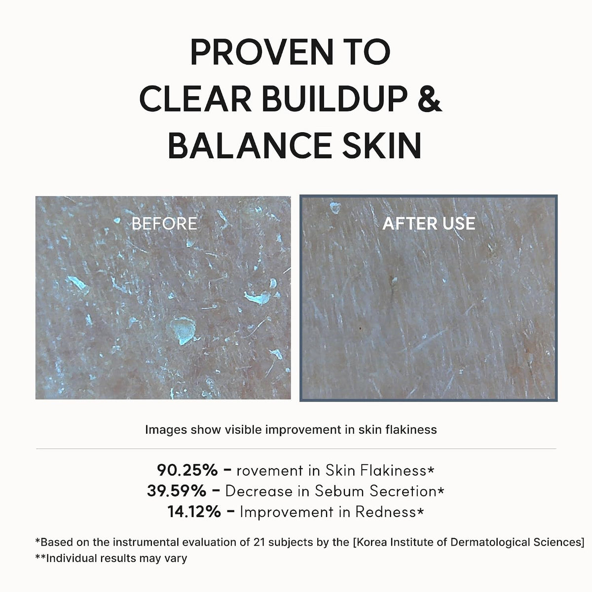 Arencia Eraser Shot Serum Glycolic Acid Booster with AHA BHA, Exfoliating Face Serum for Acne-Prone Skin, Pore Care & Texture Refining, Lightweight Daily Skincare, 30 mL