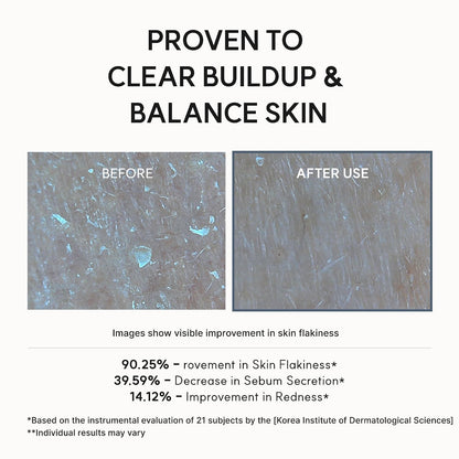 Arencia Eraser Shot Serum Glycolic Acid Booster with AHA BHA, Exfoliating Face Serum for Acne-Prone Skin, Pore Care & Texture Refining, Lightweight Daily Skincare, 30 mL