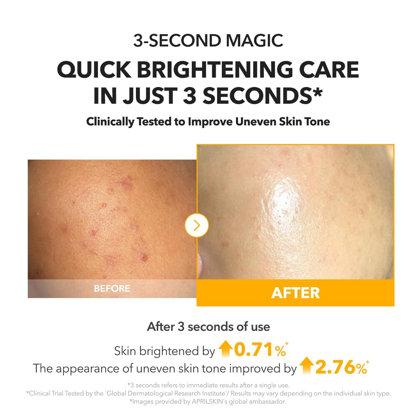 APRILSKIN A.C.E Serum – Vita Kojic Brightening Serum (3.88 oz / 110ml) ✨🍊