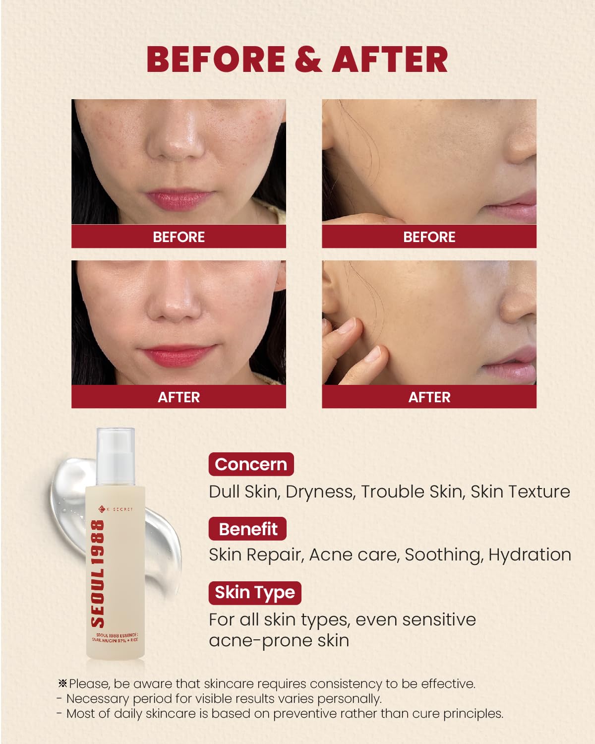 K-SECRET SEOUL 1988 Snail Mucin 97% Essence 100ml / 3.38 fl oz