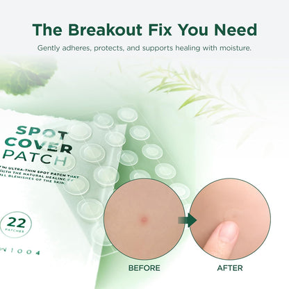 SKIN1004 Tea-Trica Spot Cover Patch (22 Patches) 🌿✨