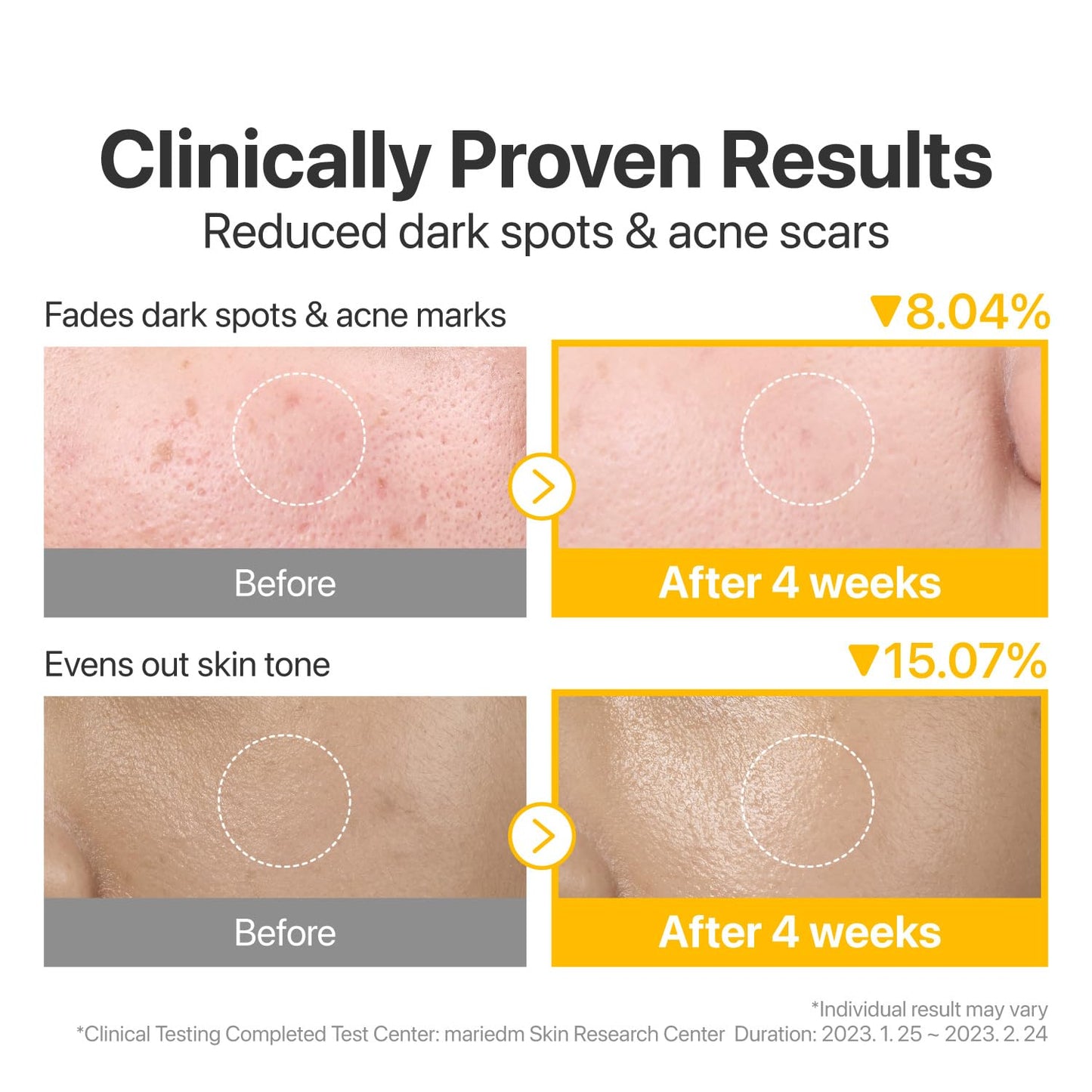 numbuzin No.5 Glutathione Dark Spots Set