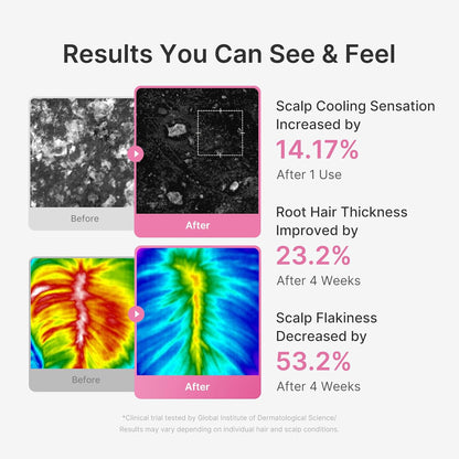 Medicube Rosemary PDRN Scalp Refresh & Nourish Serum (20ml) 🌿✨