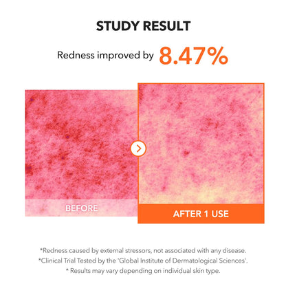 APRILSKIN Carrotene IPMP™ Clearing Solution – 0.67 fl oz / 20ml 🌿✨