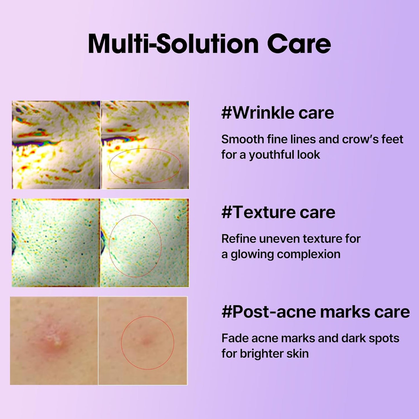 SOME BY MI Retinol Intense Reactivating Serum – 30ml / 1.01 oz 🌙✨