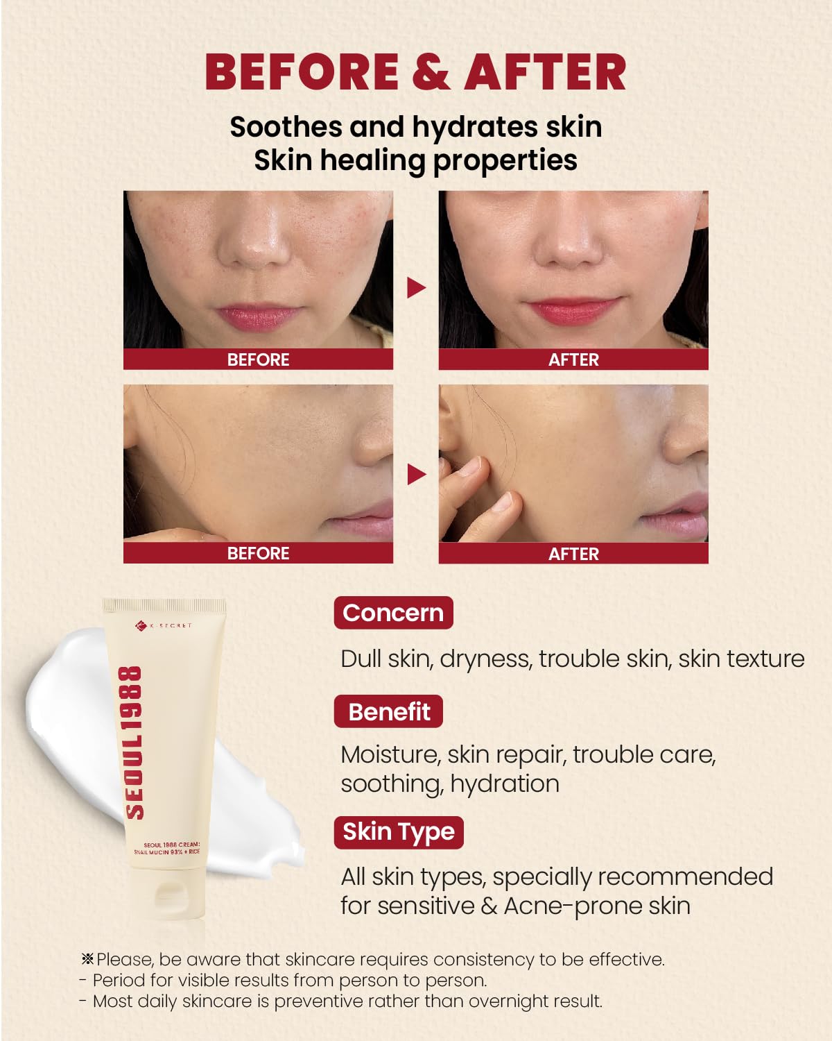 K-SECRET SEOUL 1988 Snail Mucin 93% Cream