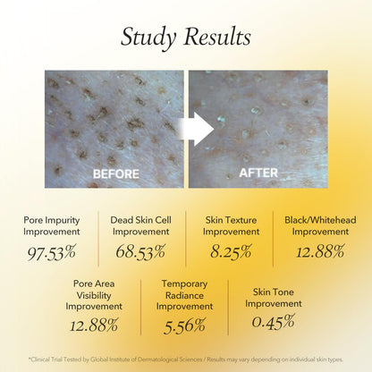 APRILSKIN Calendula Flower-Infused Facial Peel Off Mask – 3.52 fl oz / 100ml 🌼✨