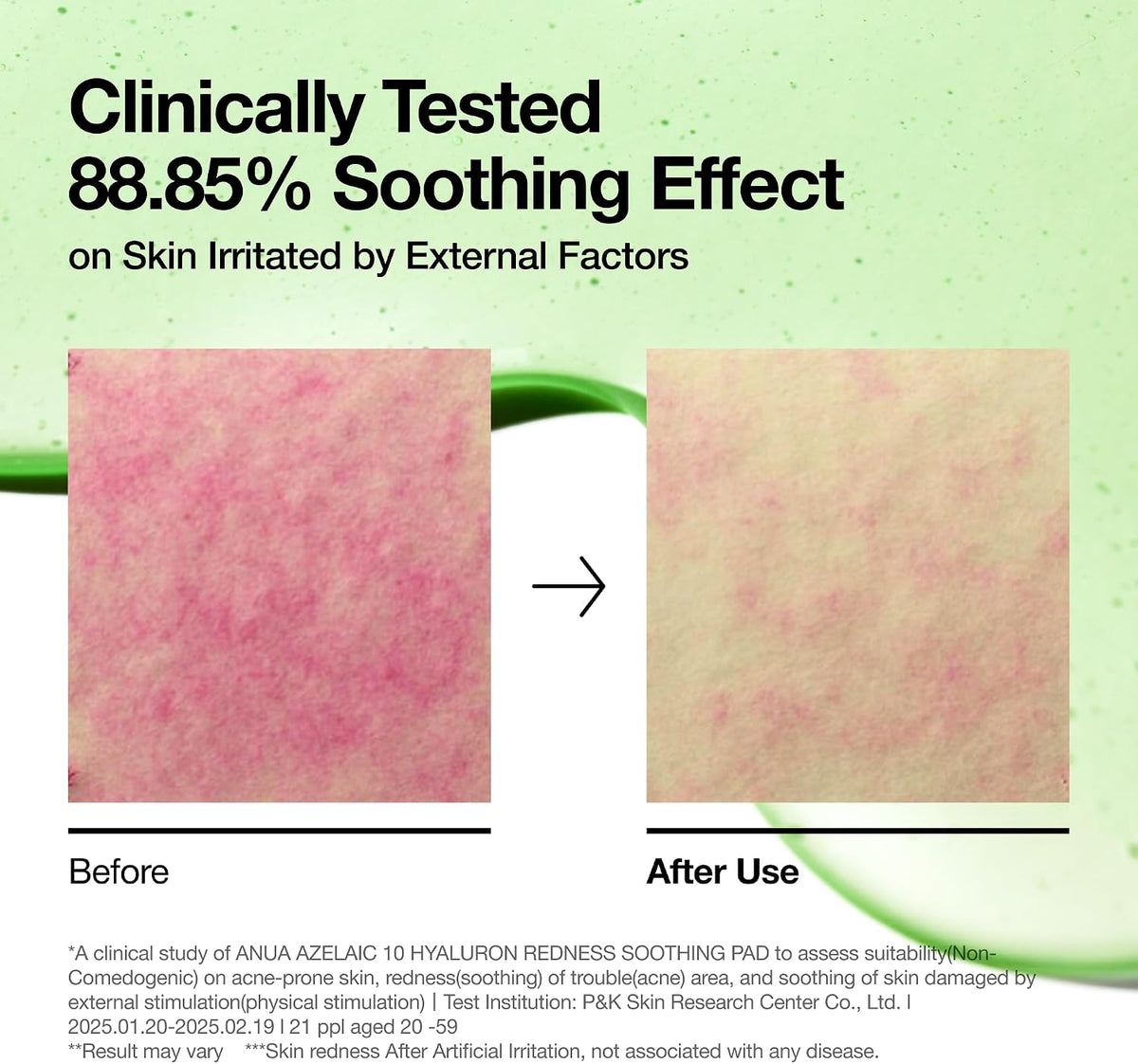 Anua Azelaic 10 Hyaluron Redness Soothing Pad 230ml (90 Pads)