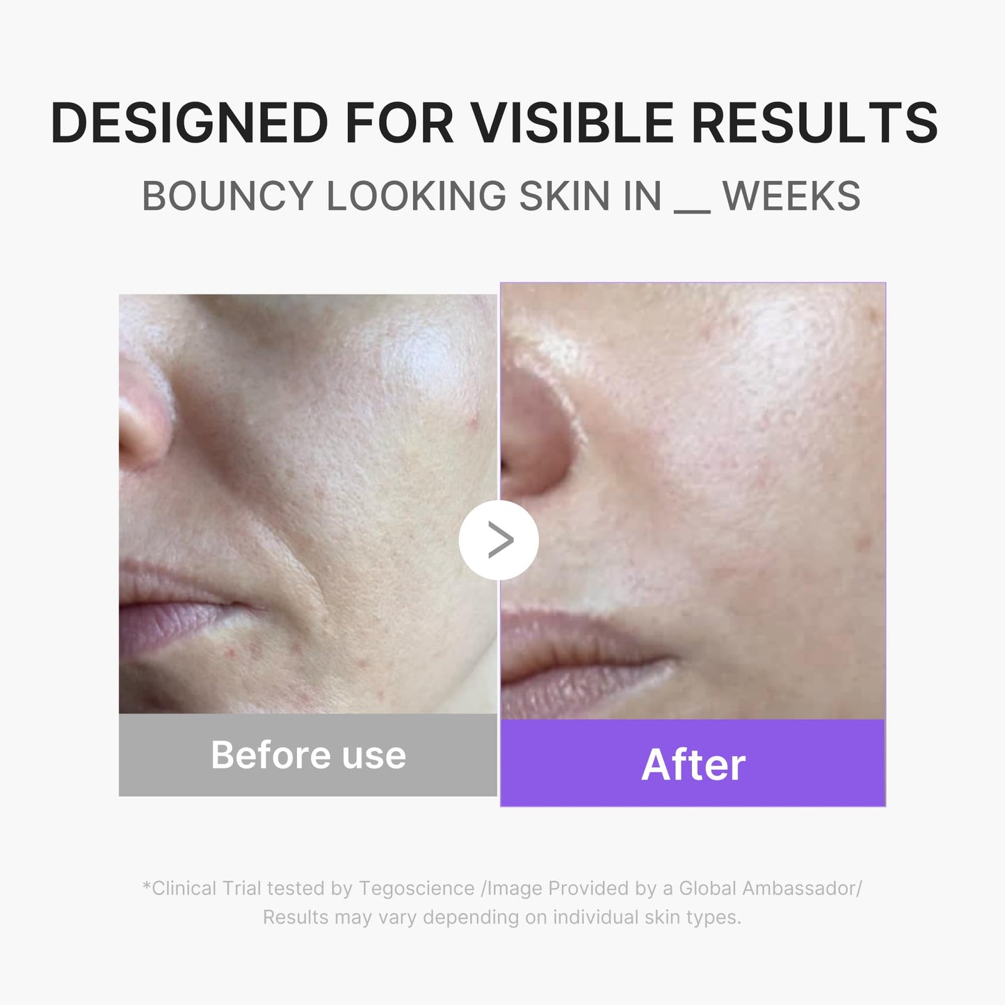 MEDICUBE All-in-One Skin Booster Device & Skincare Set
