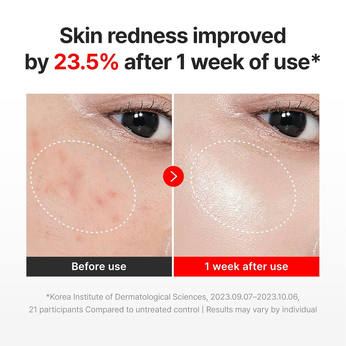 CENTELLIAN 24 Madeca Time Reverse Cream 1.69 fl oz + Vitamin 15+ Glowing Serum 1.01 fl oz – Korean Skin Care Set for Anti Aging, Uneven Tone, Blemish Corrector, Firming & Hydration
