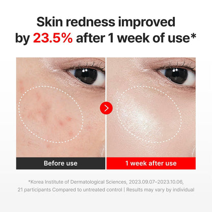 CENTELLIAN 24 Madeca Time Reverse Cream 1.69 fl oz + Vitamin 15+ Glowing Serum 1.01 fl oz – Korean Skin Care Set for Anti Aging, Uneven Tone, Blemish Corrector, Firming & Hydration