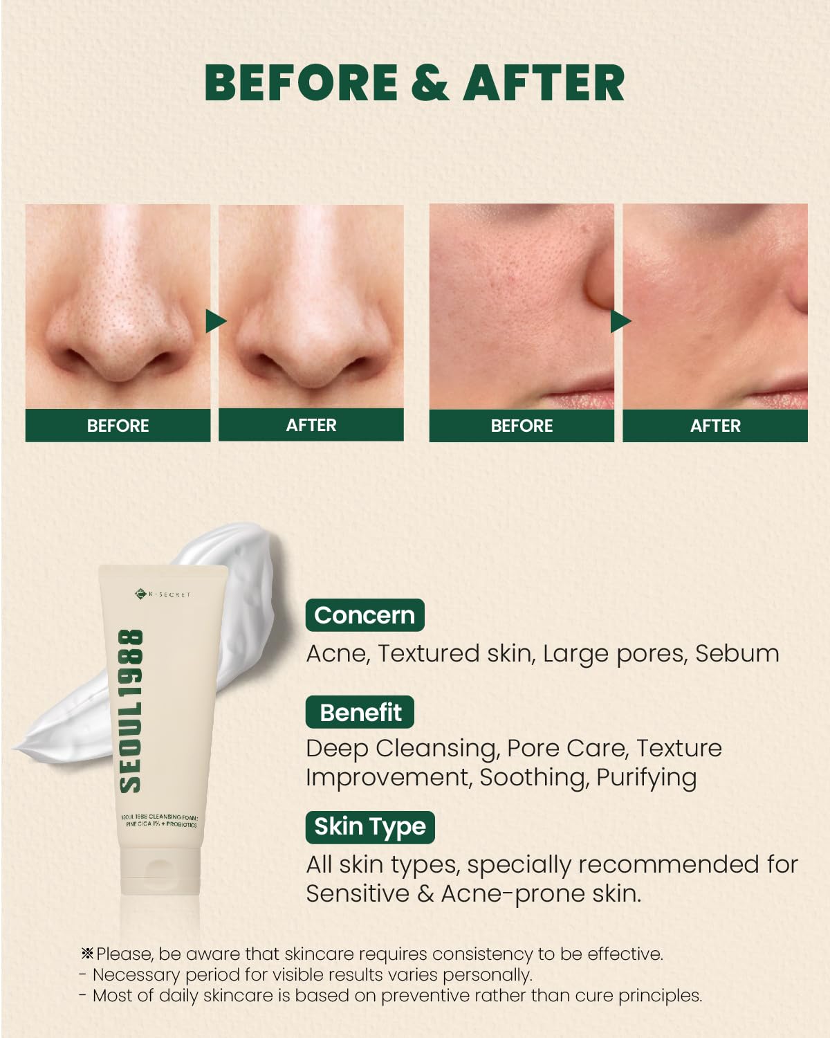 K-SECRET SEOUL 1988 Cica Cleansing Foam
