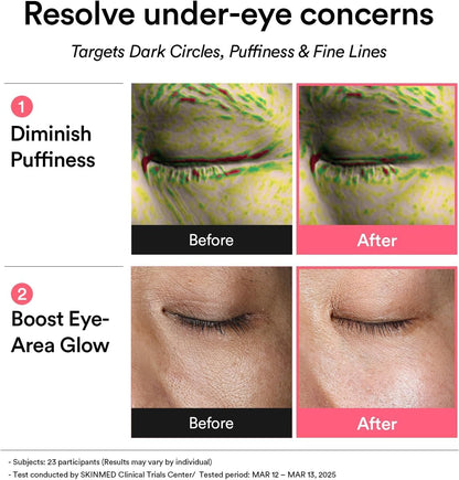 [ABIB] PDRN Retinal Eye Patch Glow Jelly (60 Patches)