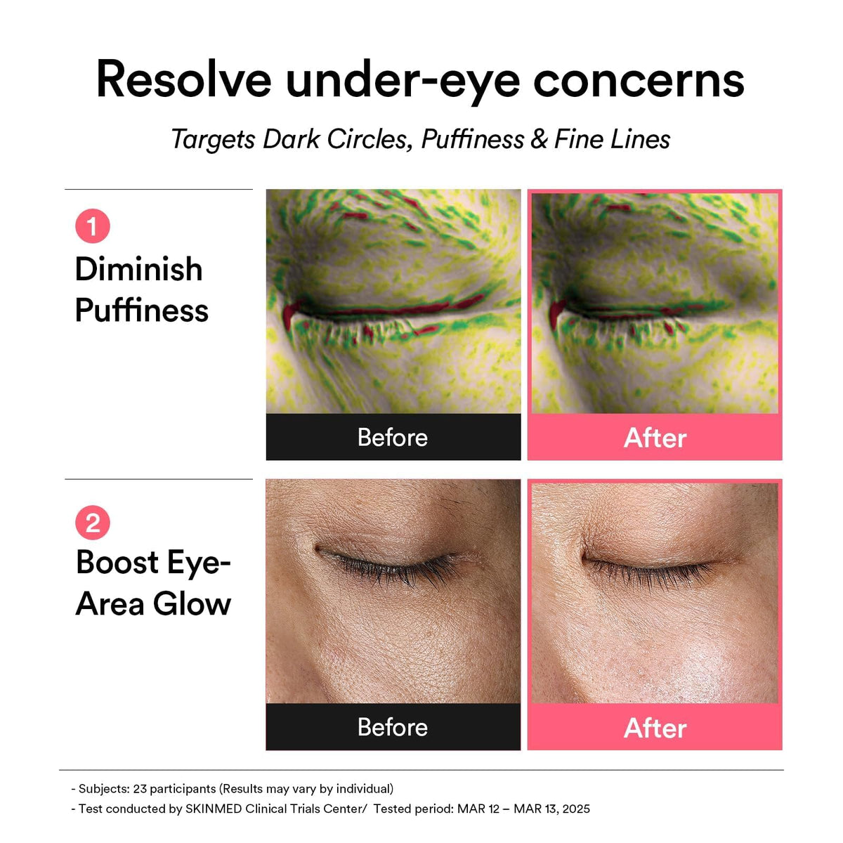 Abib Vegan Collagen Eye Patches for Wrinkles & Fine Line with Jericho Rose Jelly & Peptides, 60 Counts