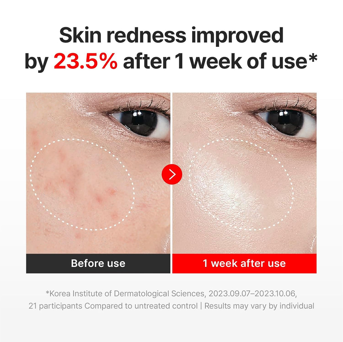 CENTELLIAN 24 Madeca Time Reverse Cream +Matcha Cleansing Oil+Peeling Gel Bundle (1.69+6.76+5.07 fl oz)Korean Skin Care Set for Deep Cleansing, Gentle Exfoliation, Firming & Wrinkle Care with Centella