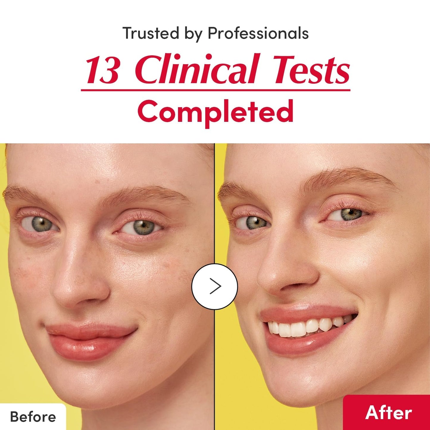 EQQUALBERRY Bakuchiol & Vitamin C Serum Set