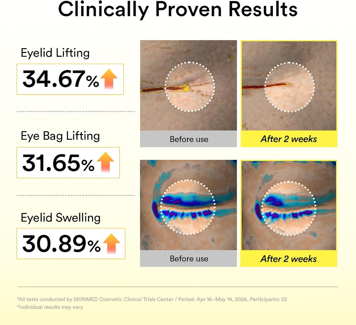 ABIB Retinal Eye Serum Lifting Roller (20ml)