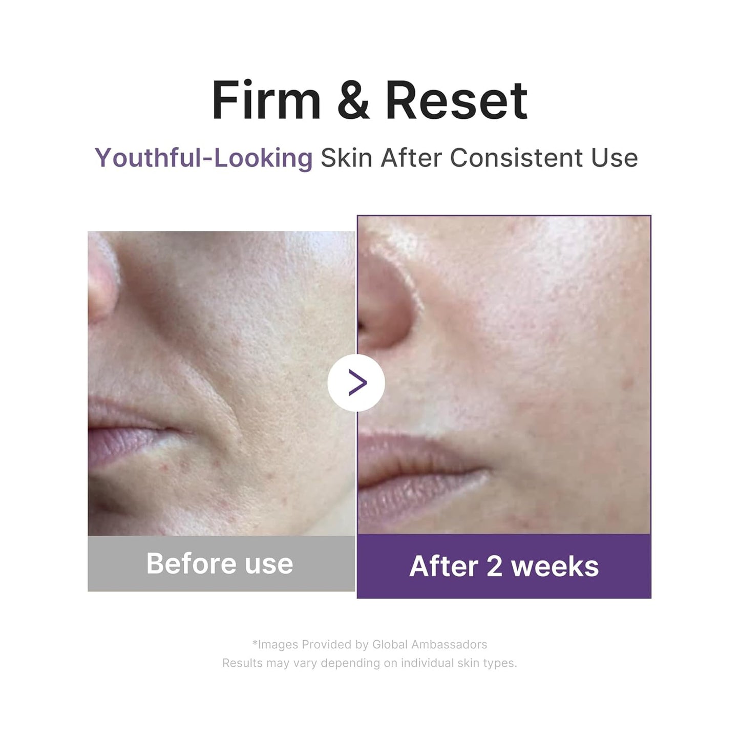 MEDICUBE Retinol & Vitamin C Radiance Duo