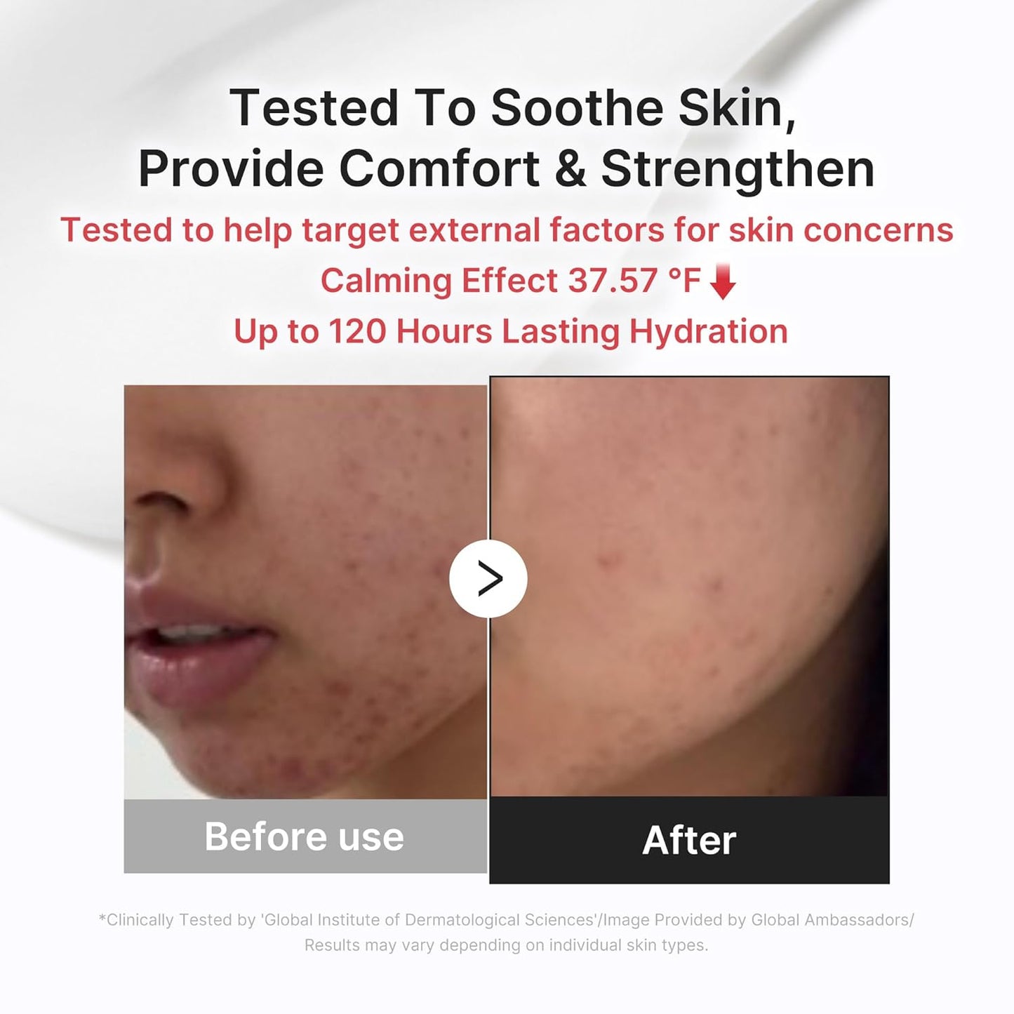 Medicube Comforting Serum & Cream Duo 💧✨