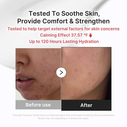 Medicube Comforting Serum & Cream Duo 💧✨