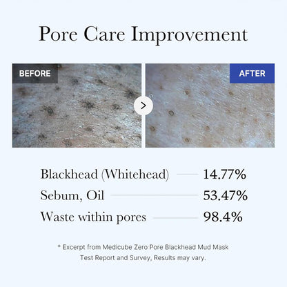 Medicube Zero Pore Blackhead Mud Mask with Jelly Brush 🧼✨