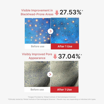 medicube Hypochlorous Acid Peel Mask (3EA)