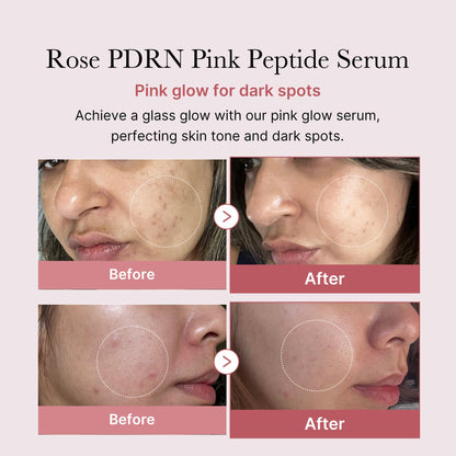 Medicube PDRN Pink Peptide Serum, Pink glow serum, Peptide, Niacinamide, Hydrating & Moisturizing & Firming, Uneven Skin Tone, Korean Skincare | 30ml, Rose PDRN (Vegan))