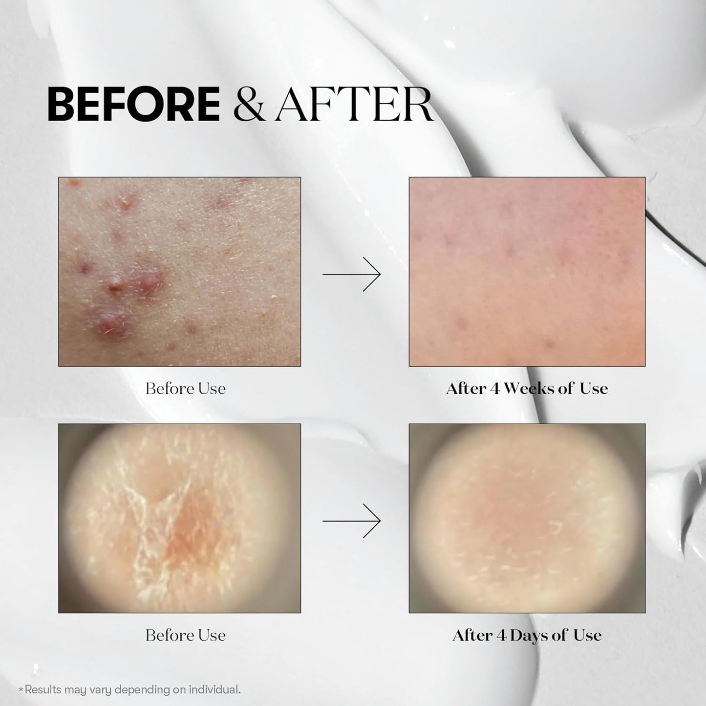 [VT COSMETICS] 100 REEDLE SHOT STICK POUCH (10ea)