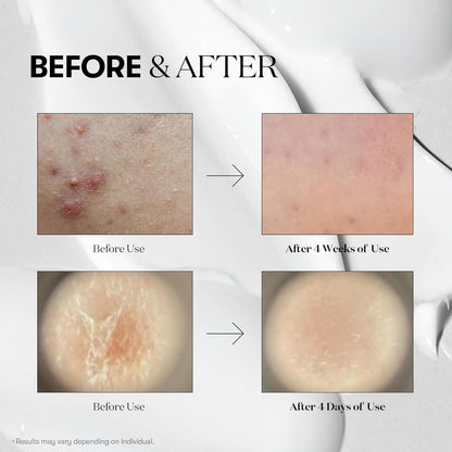 [VT COSMETICS] 100 REEDLE SHOT STICK POUCH (10ea)