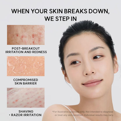 Arencia Eraser Shot Glycolic Acid Booster Serum and Soothing Cream