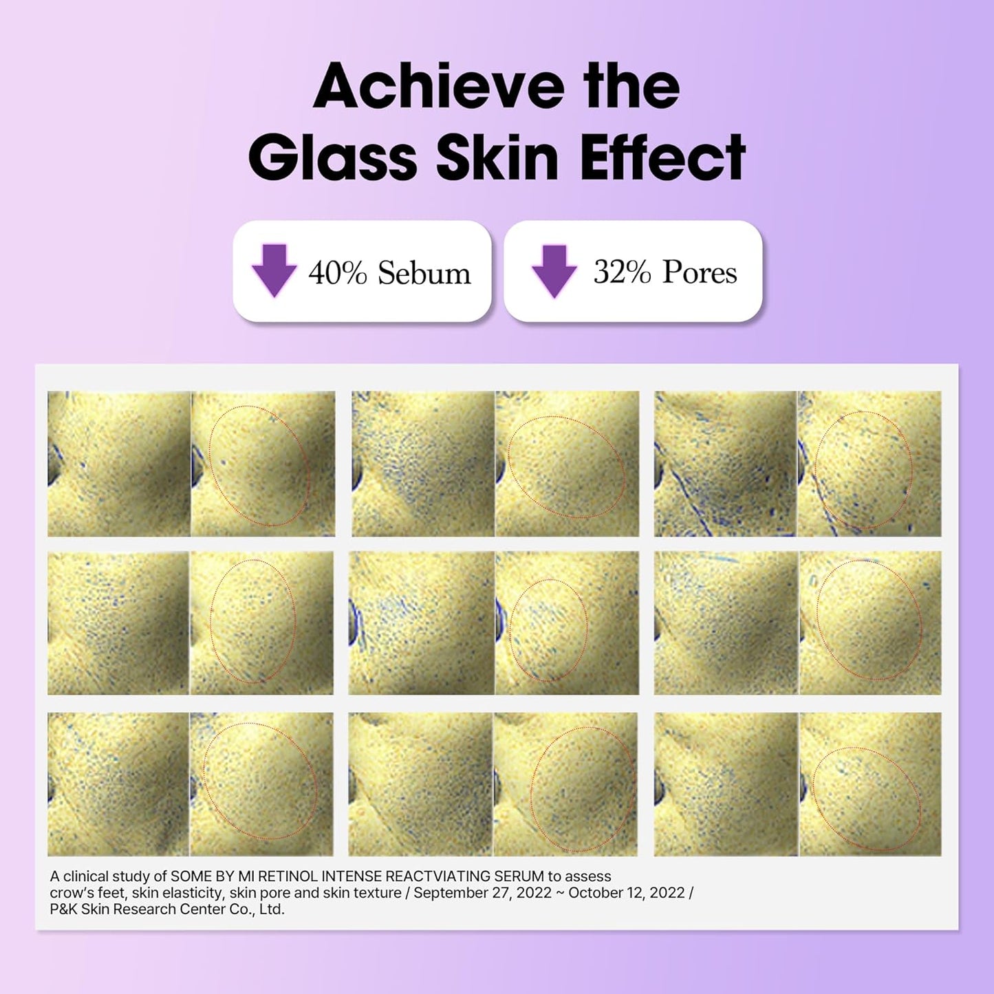 SOME BY MI Retinol Intense Reactivating Serum – 30ml / 1.01 oz 🌙✨