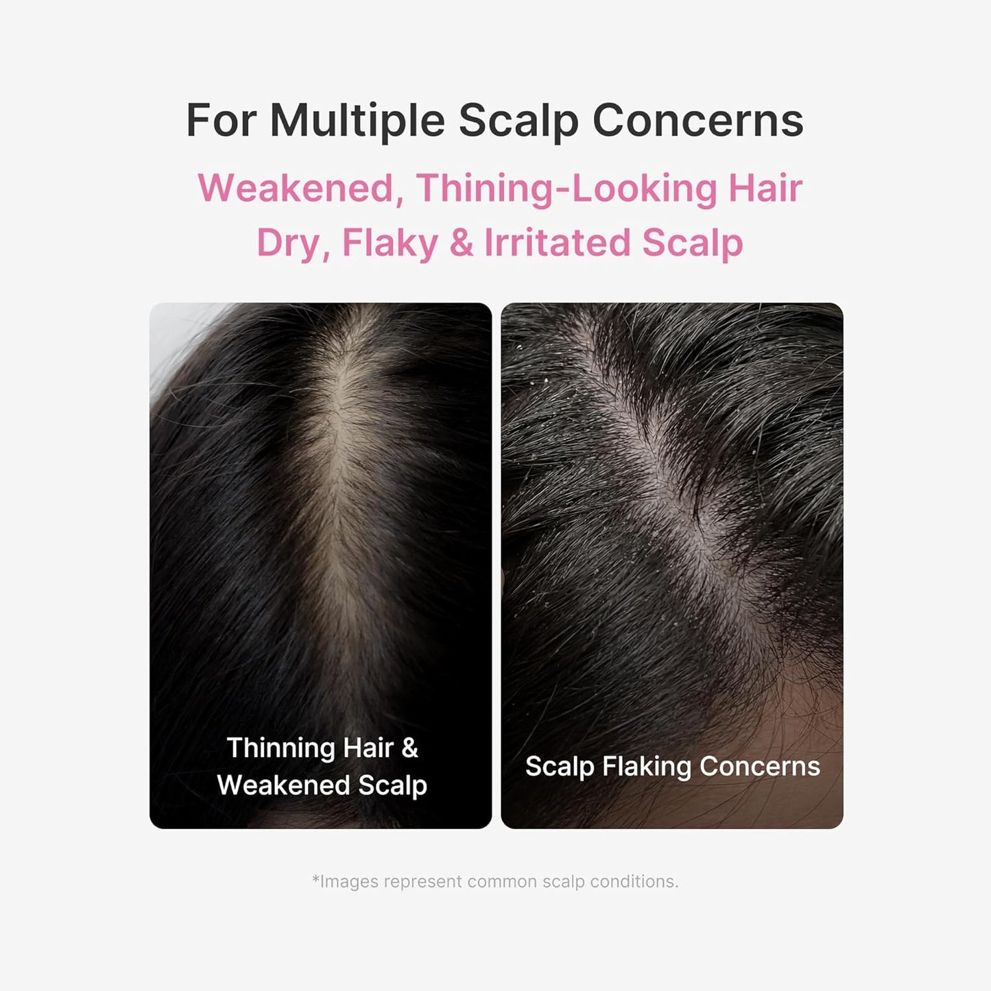 Medicube Rosemary PDRN Scalp Refresh & Nourish Serum (20ml) 🌿✨