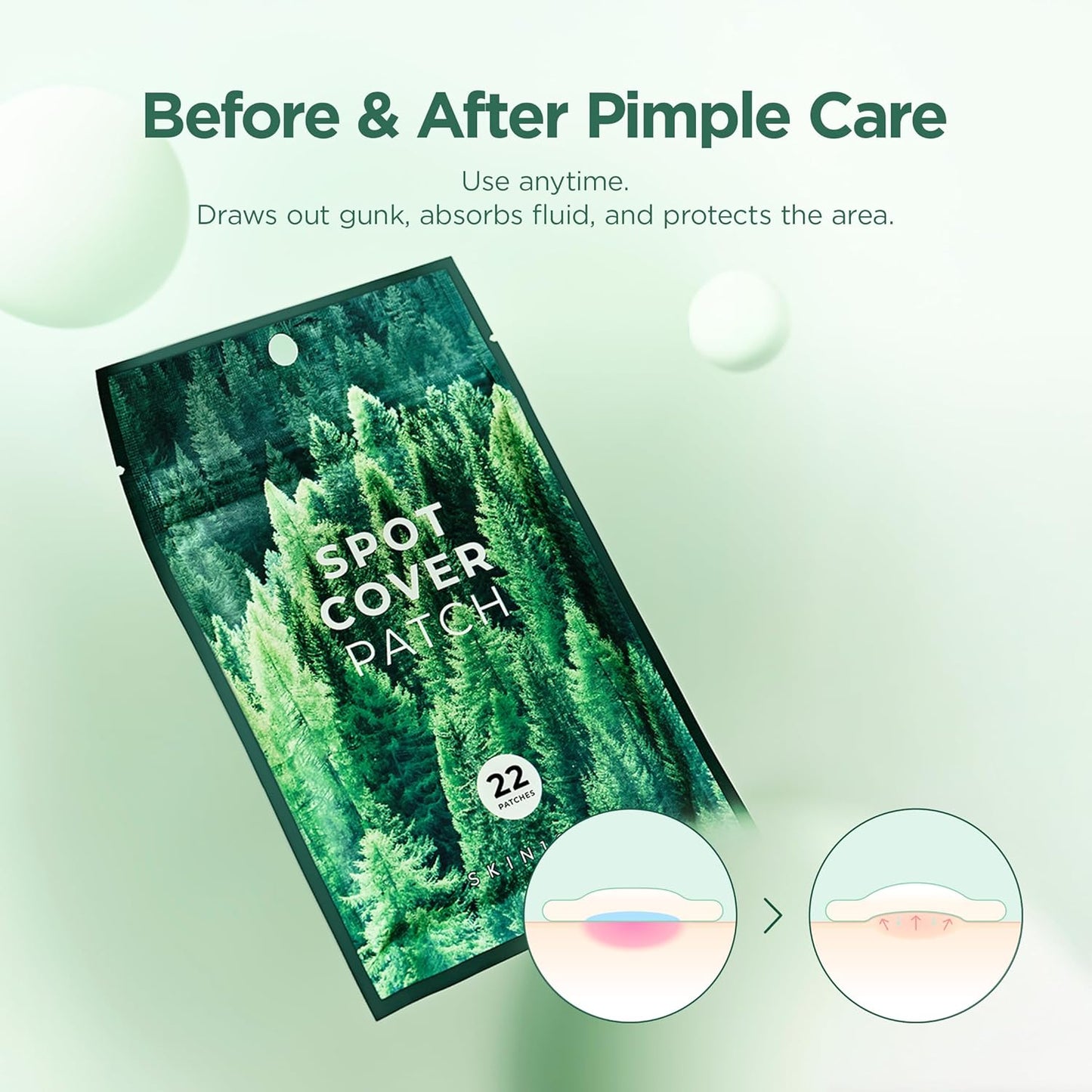 SKIN1004 Tea-Trica Spot Cover Patch (22 Patches) 🌿✨
