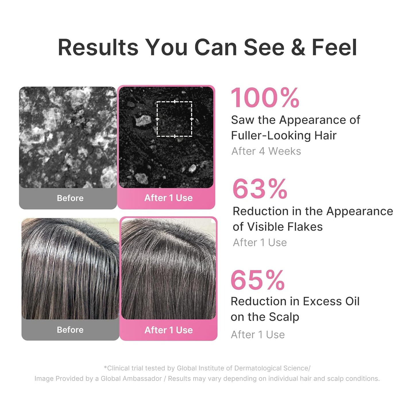 Medicube Rosemary PDRN Clarifying Shampoo (400ml / 13.52 fl. oz) 🌿🧼