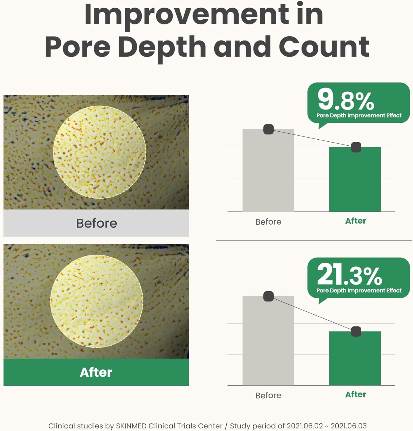 [AXIS-Y] Mugwort Pore Clarifying Wash Off Pack - 100 ml