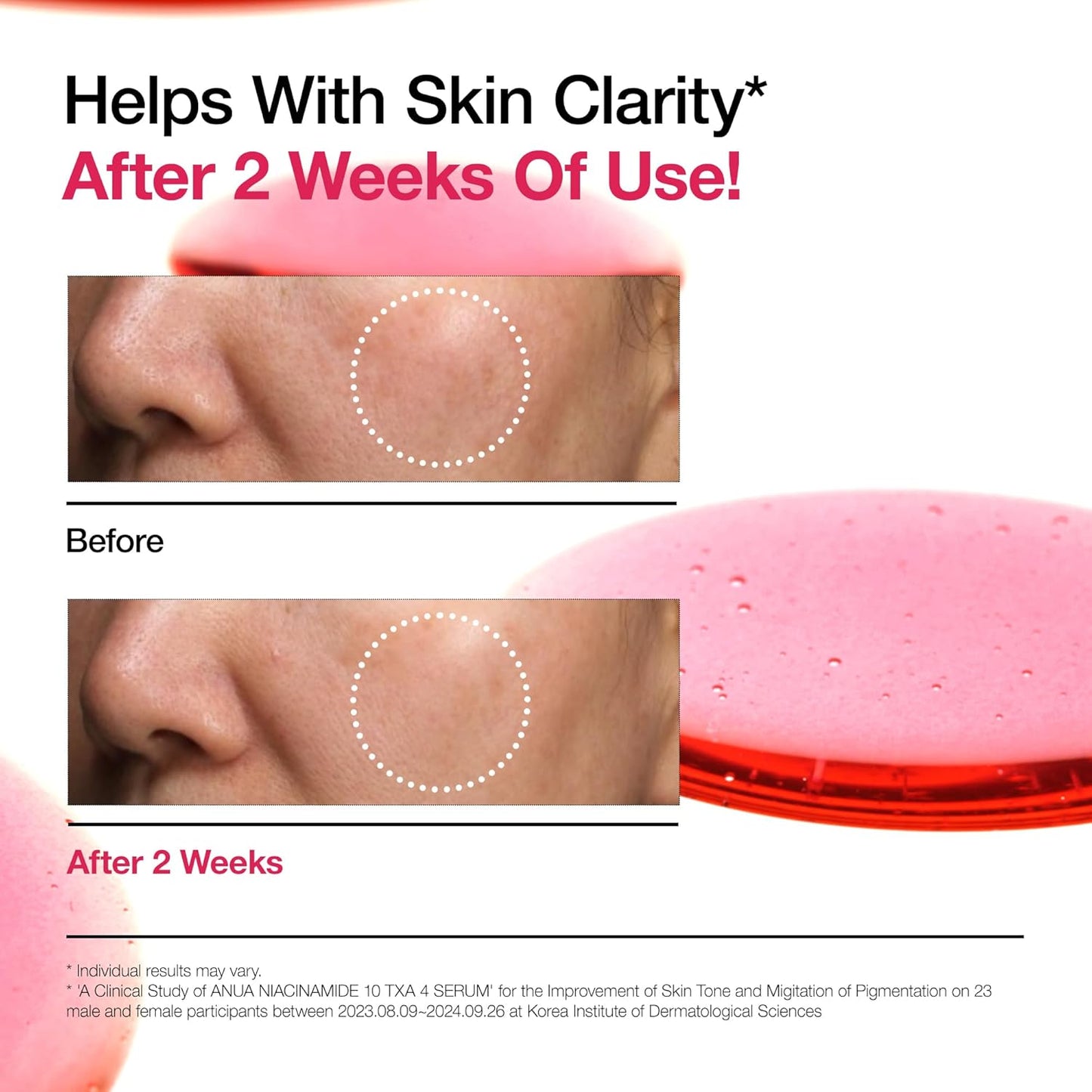 [Anua] Niacinamide 10% + TXA 4% Dark Spot Correcting Serum 30ml