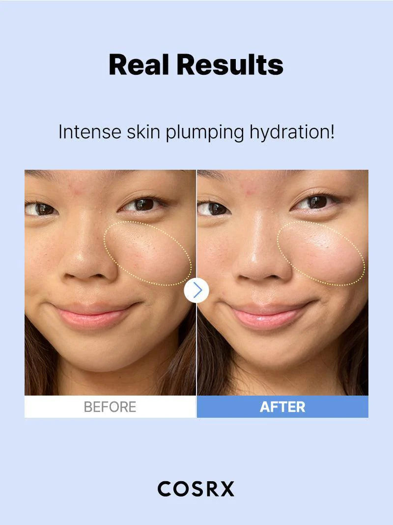 COSRX The Hyaluronic Acid 3 Serum – Deep Hydration for Plump, Supple Skin