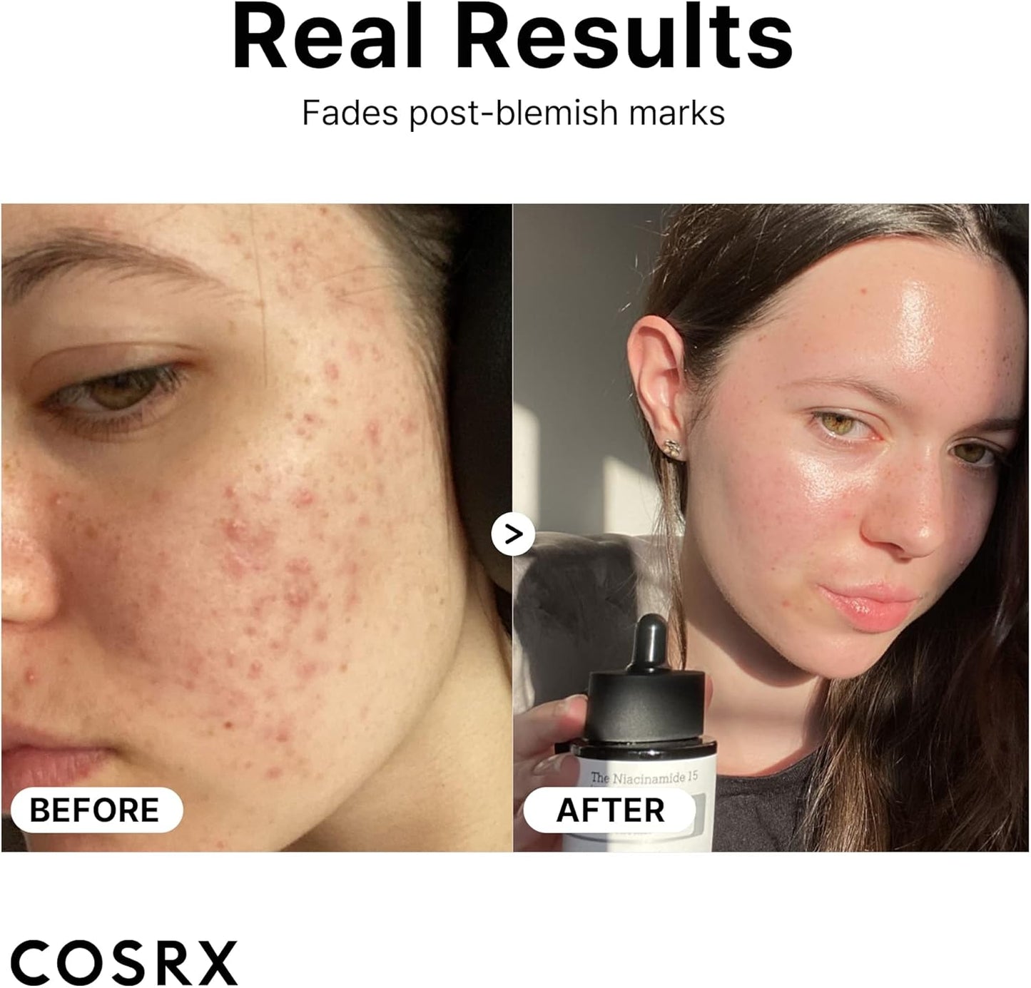 [Cosrx] The Niacinamide 15 Serum 20ml