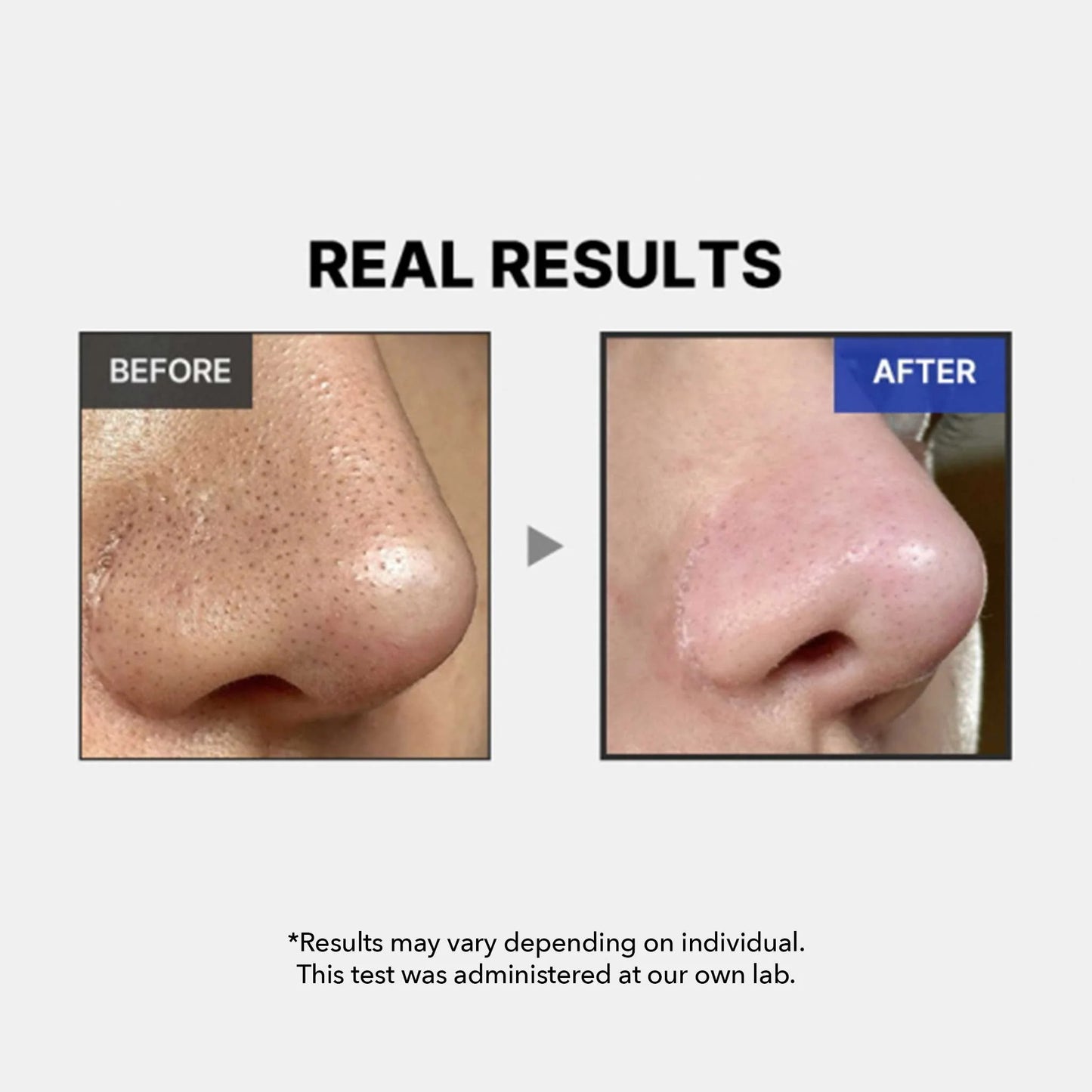 [MEDICUBE] مجموعة برو ميني بوستر ليوم واحد 2000