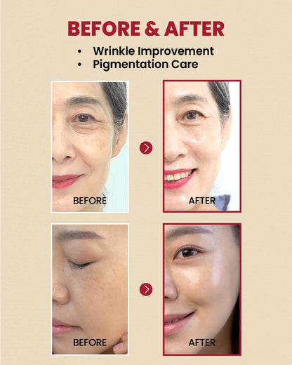 [KSECRET] SEOUL 1988 Serum : Retinal Liposome 2% + Black Ginseng