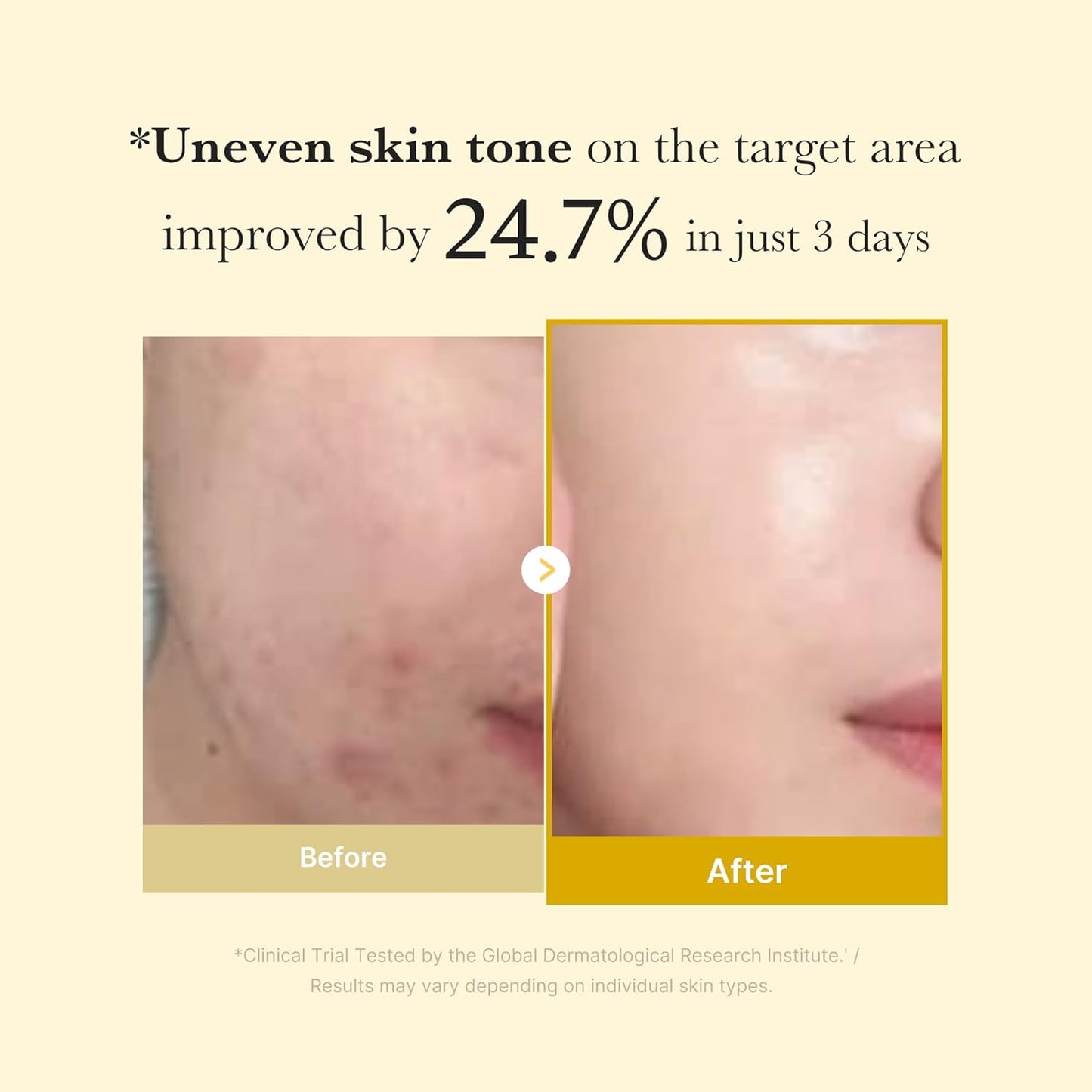 [Medicube] KOJIC ACID TURMERIC NIGHT WRAPPING MASK 75ML